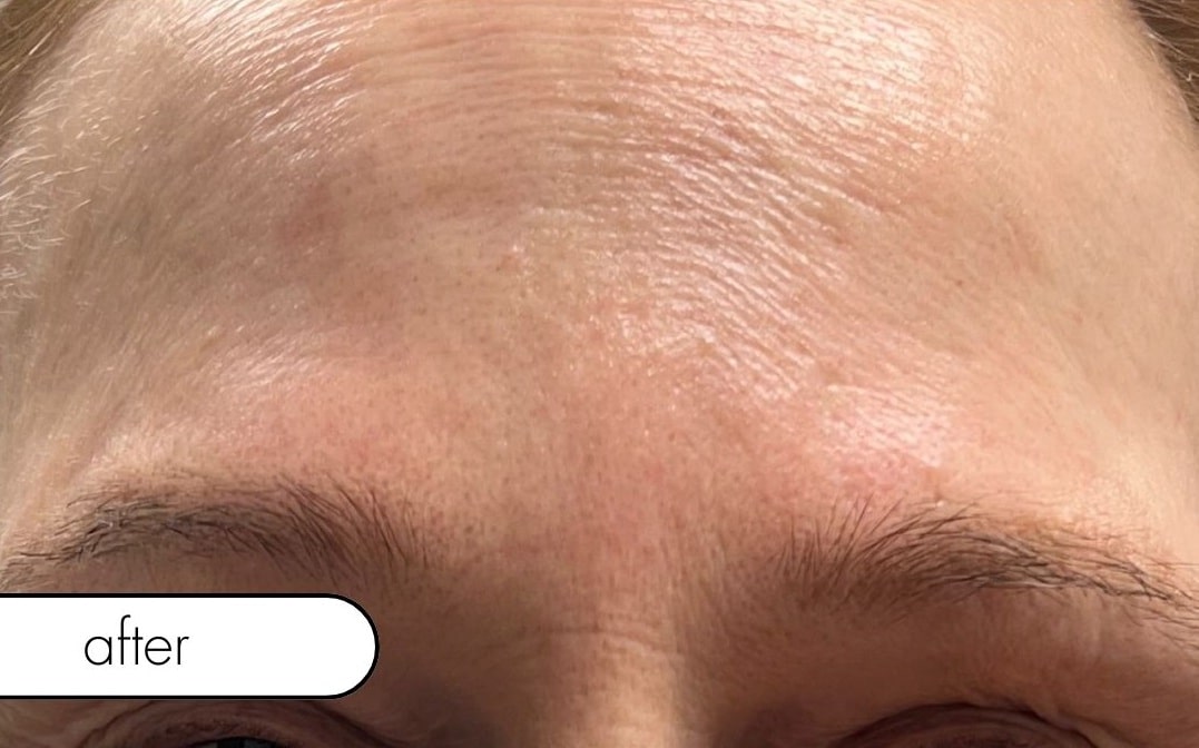 After Image: Wrinkle Relaxer - front