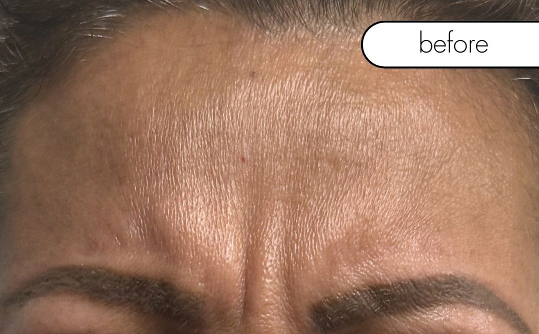 Before Image: Wrinkle Relaxer - front