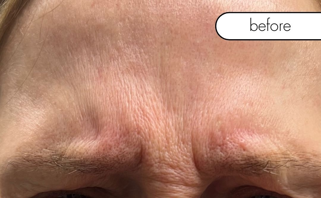 Before Image: Wrinkle Relaxer - front
